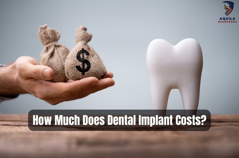 How Much Does Dental Implant Costs?